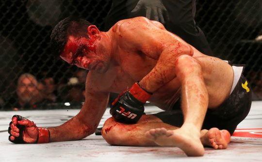 zdjęcie zakrwawionego gościa z gali MMA